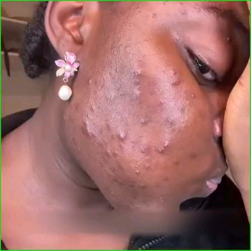 Green mask stick